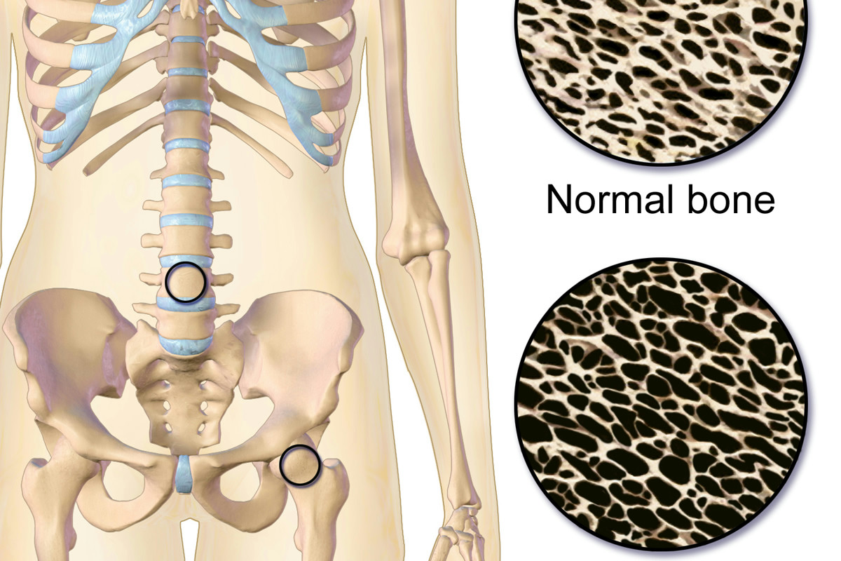 Allenamento mirato dopo i 40 anni: come potenziare le ossa e contrastare l’osteoporosi